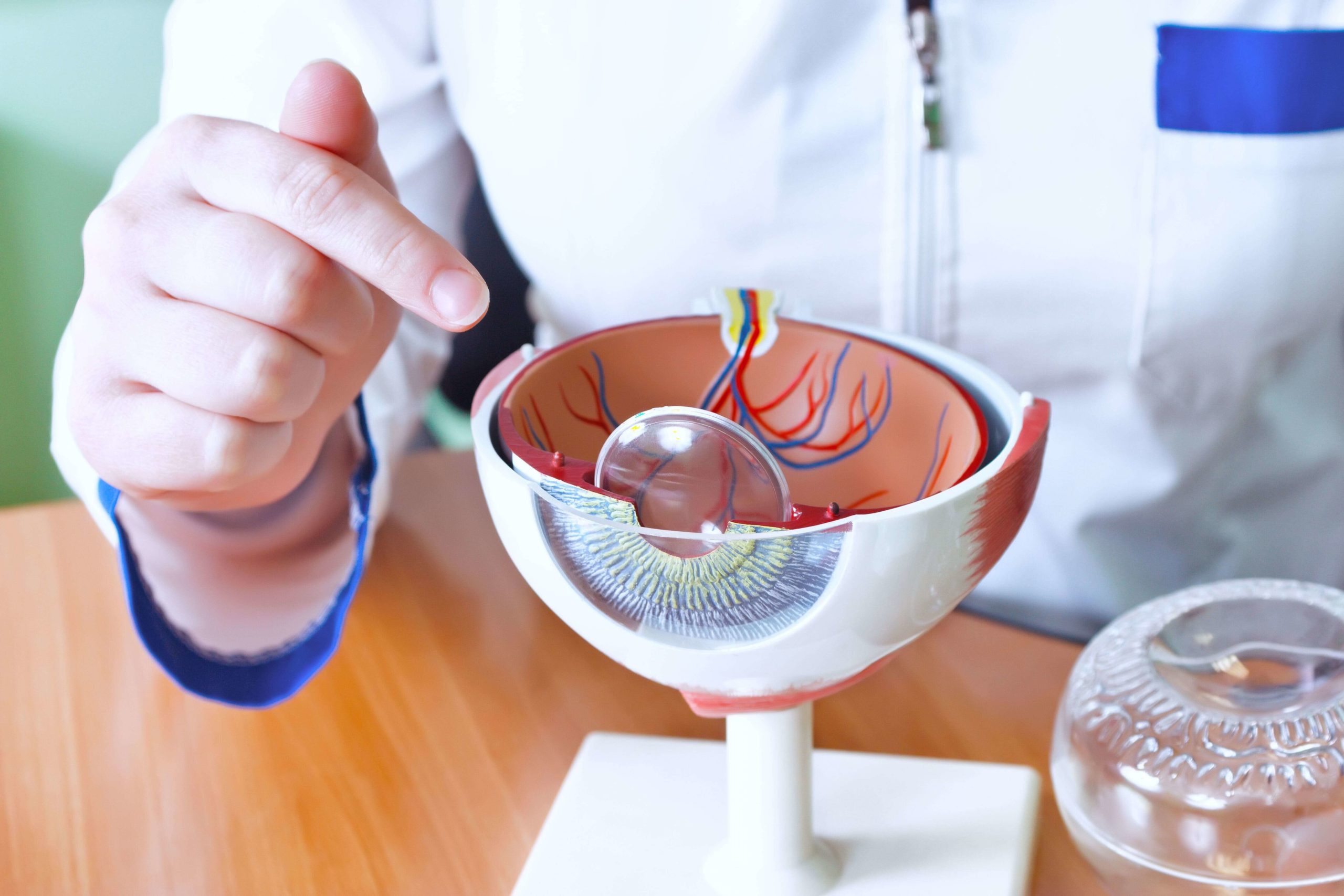 What are Cataract?